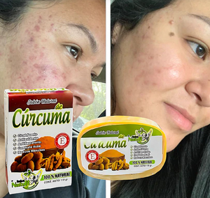 JABON DE CURCUMA 100% NATURAL