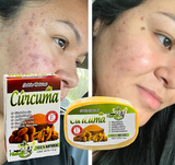 JABON DE CURCUMA 100% NATURAL